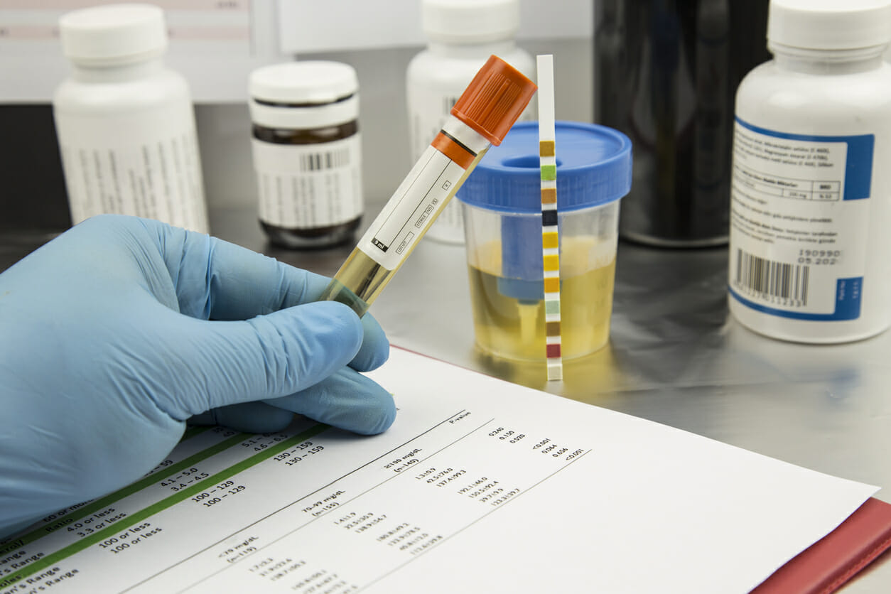 Can Psilocybin Be Detected in a Drug Test?